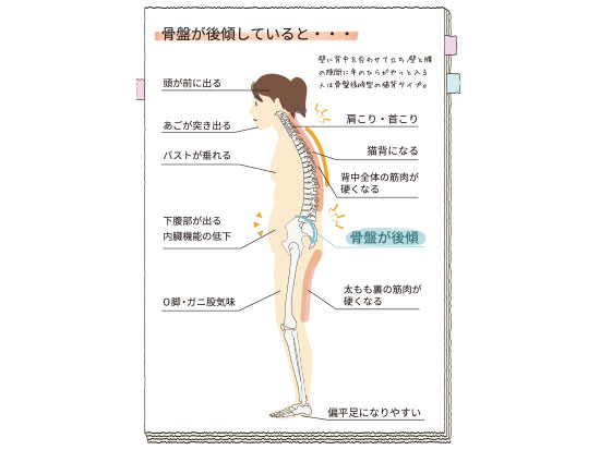 「骨盤後傾」